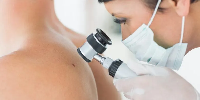 Getting Life Insurance After Skin Cancer [2022 Guide]