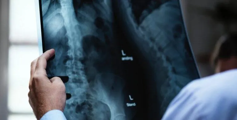How To Buy Life Insurance With Pre-Existing Conditions In 2023