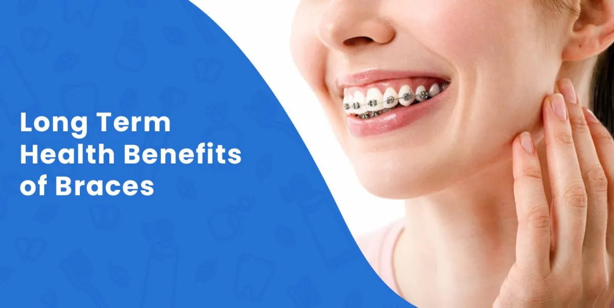 Long Term Health Benefits of Braces