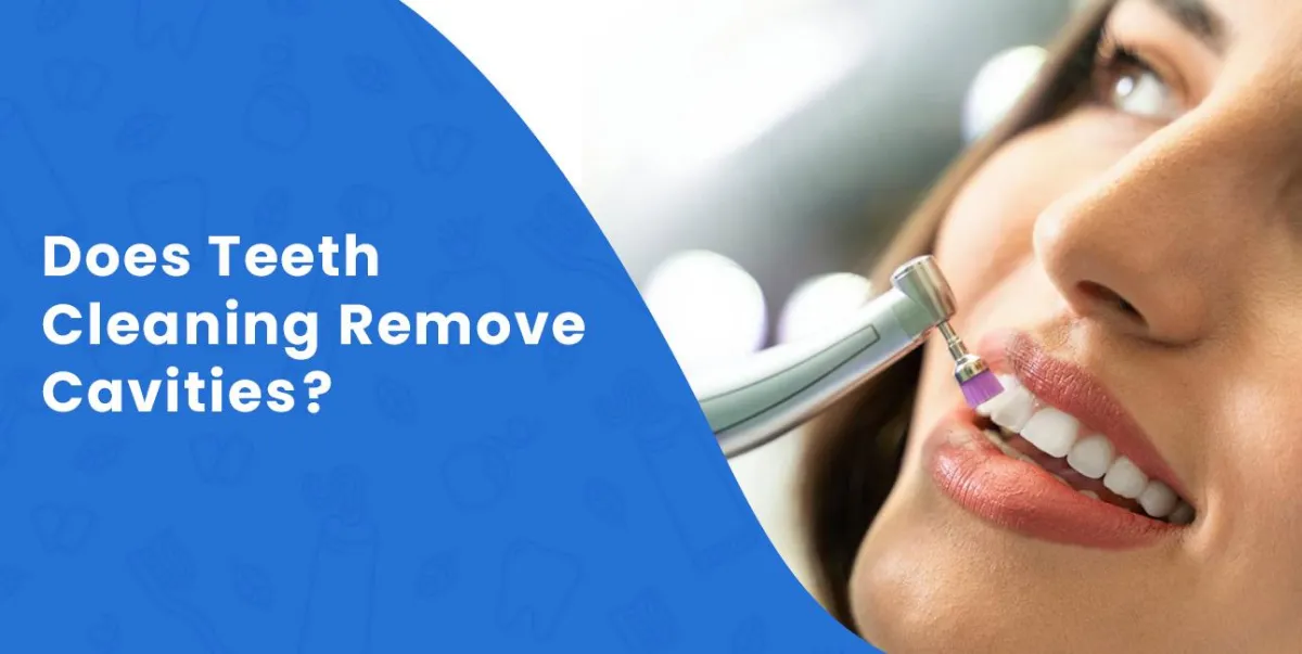 Does Teeth Cleaning Remove Cavities?