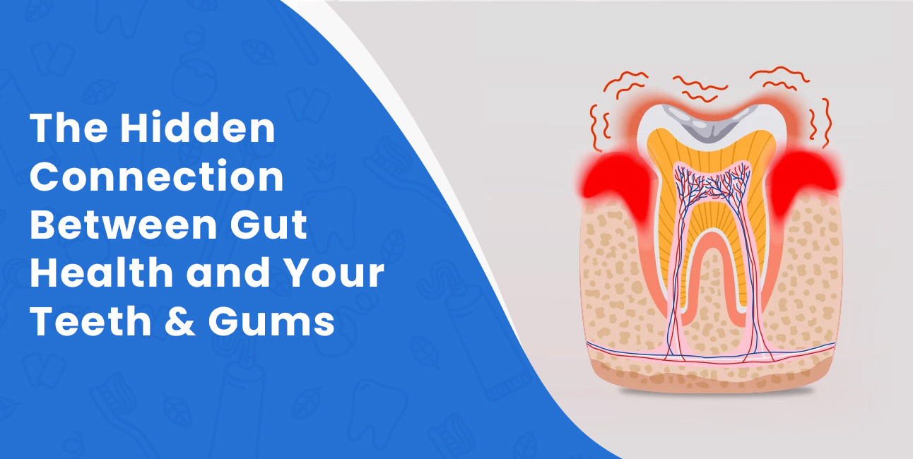The Hidden Connection between Gut Health and Your Teeth & Gums