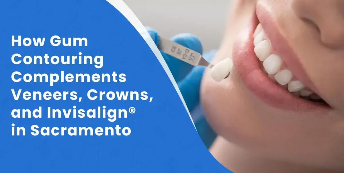 How Gum Contouring Complements Veneers, Crowns, and Invisalign® in Sacramento