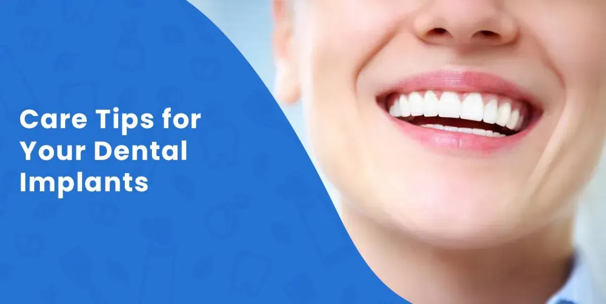 Care Tips for Your Dental Implants