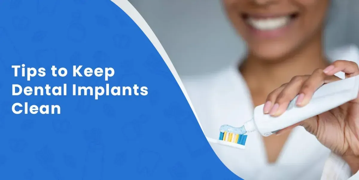 Tips to Keep Dental Implants Clean