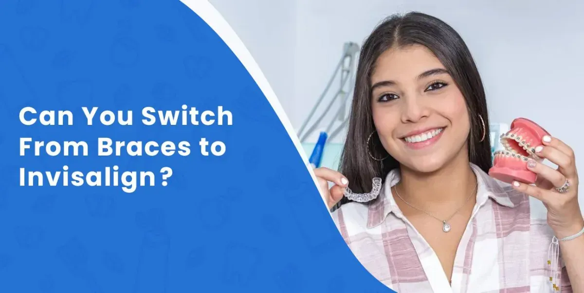 Can You Switch From Braces to Invisalign?
