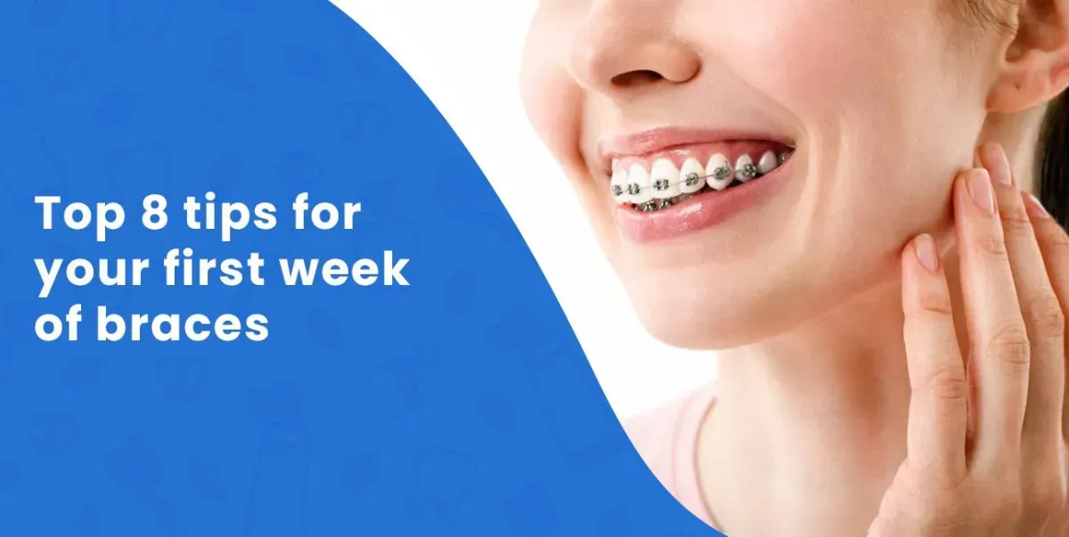 Top 8 tips for your first week of braces