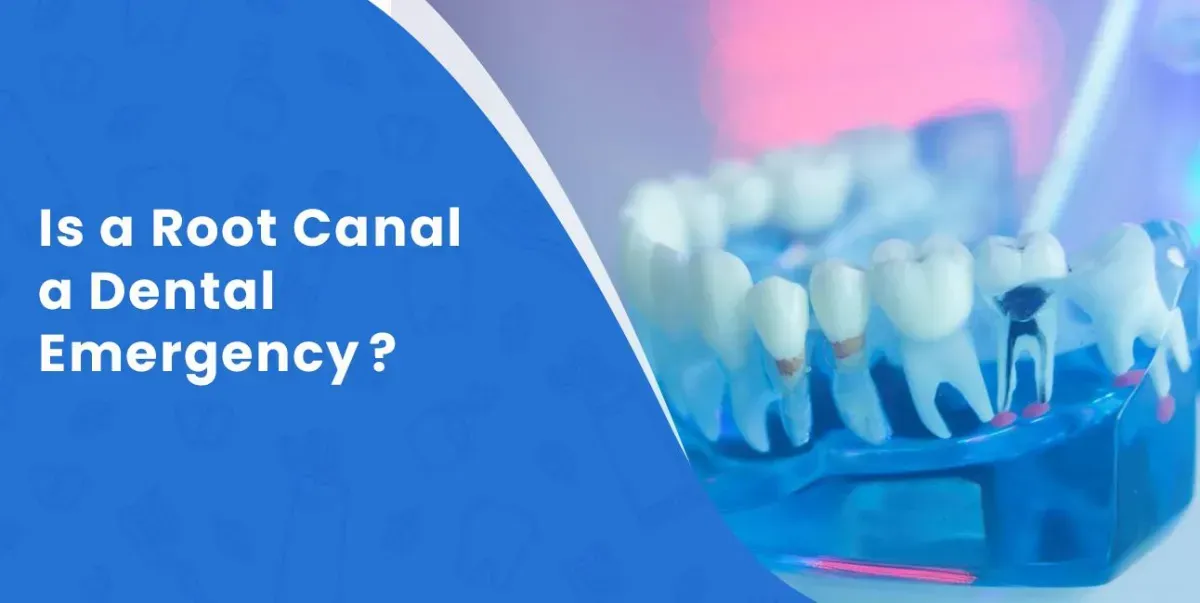Is a Root Canal a Dental Emergency?