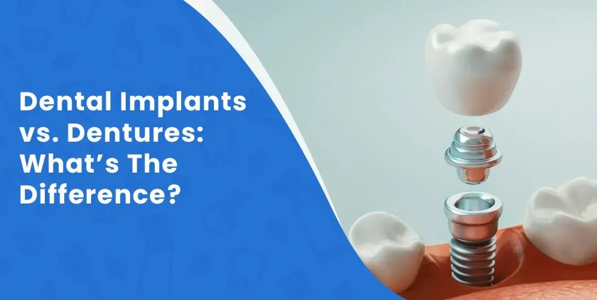 Dental Implants vs. Dentures: What’s The Difference?