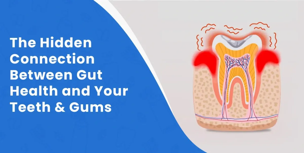 The Hidden Connection between Gut Health and Your Teeth & Gums
