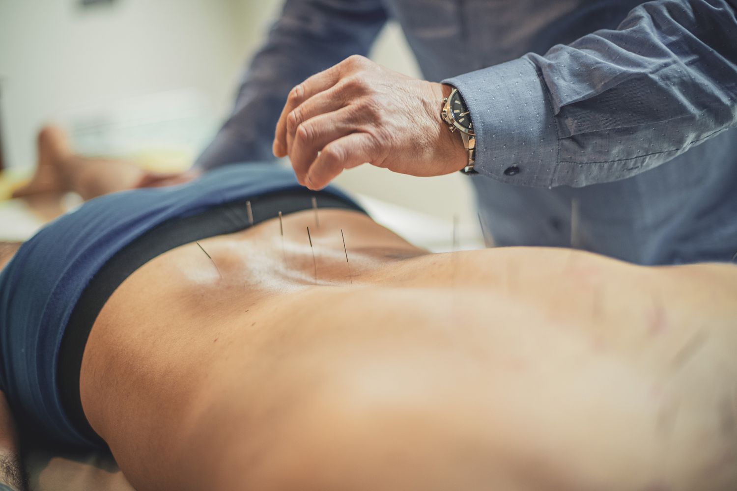 Acupuncture for Winter Muscle Tightness in Calgary