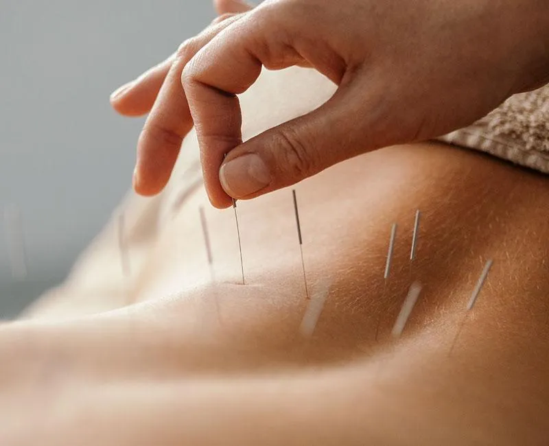 Benefits of Mobile Acupuncturist Near Phoenix Arizona