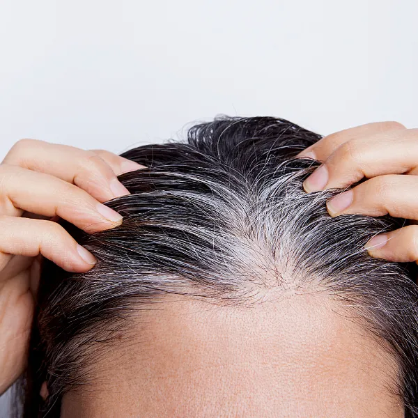 Thinning Hair - coping with female hair loss