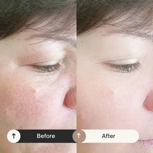 Understanding Barrier Repair: What It Is and Why It Matters for Mature Skin