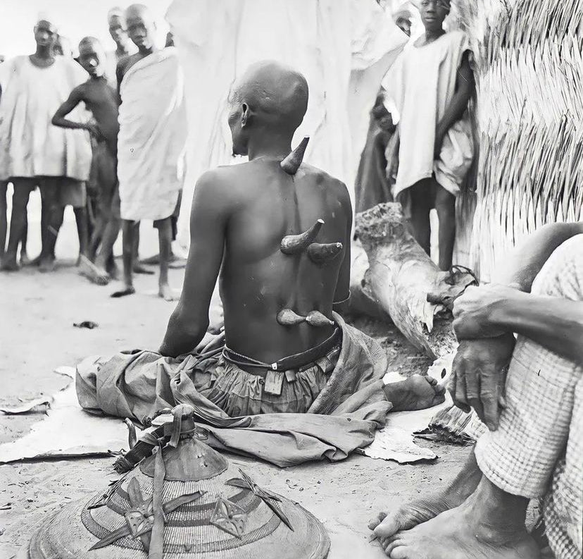 The Ancient Origins of Cupping Therapy: From Egypt to Modern Times