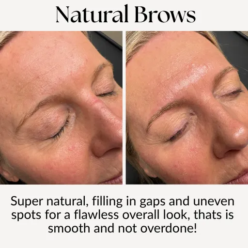 Before and after natural brow tattoo showing even, realistic results with soft definition and smooth finish by Fibroblast Australia in Geelong