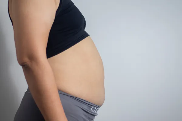 Diastasis Rectus Abdominis: Myths, Facts, and How to Heal