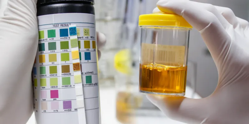 https://medline-urgent-drug-testing-inc.square.site/shop/urine-testing/HQAORBMHR3NTFVN7MD7WHWBH?page=1&limit=30&sort_by=category_order&sort_order=ascUrine Test