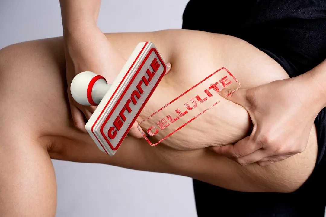 The Cellulite Deep Dive – The Real Science & the Real Fix