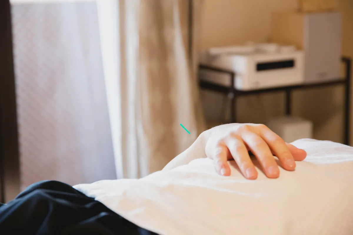 acupuncture