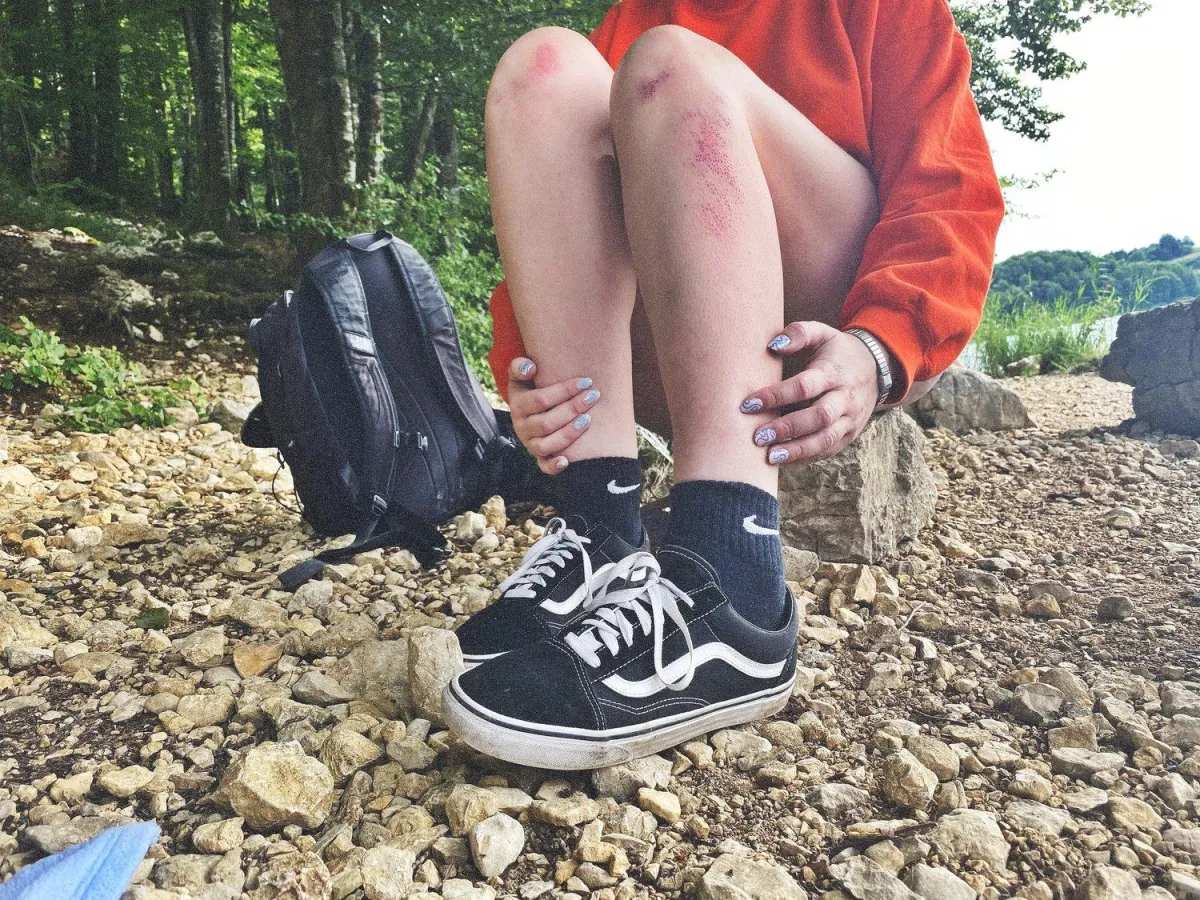 Chronic pain is like… a scratch on the leg.