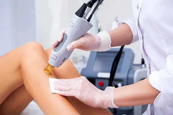 A Beginner’s Guide to Laser Hair Removal