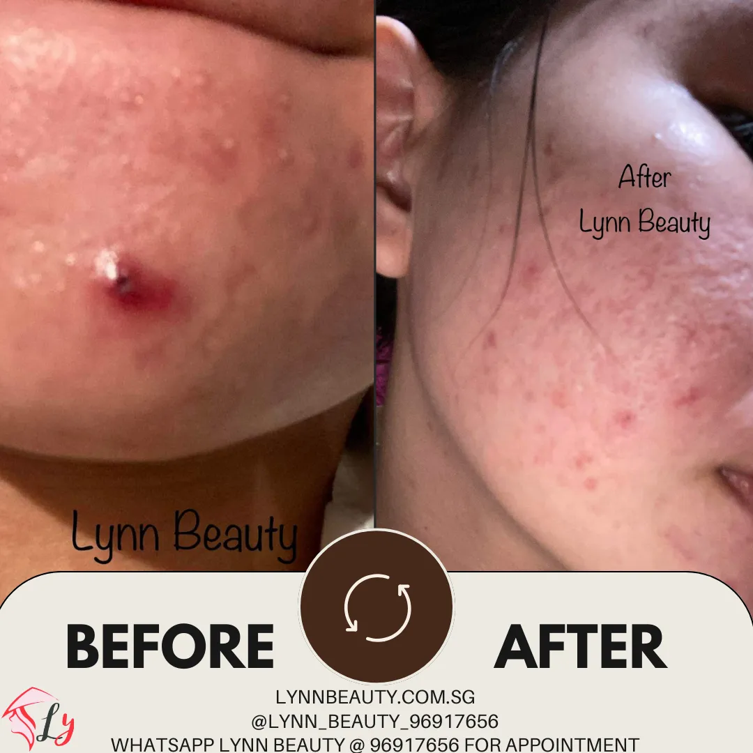 Lynn Beauty Clementi
