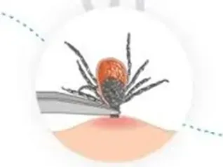 I Was Bitten By a Tick…What Do I Do??