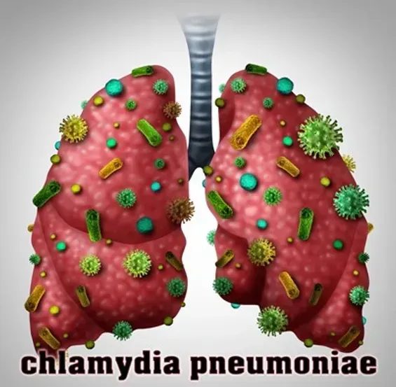Lyme Coinfection Series- Chlamydia Pneumoniae