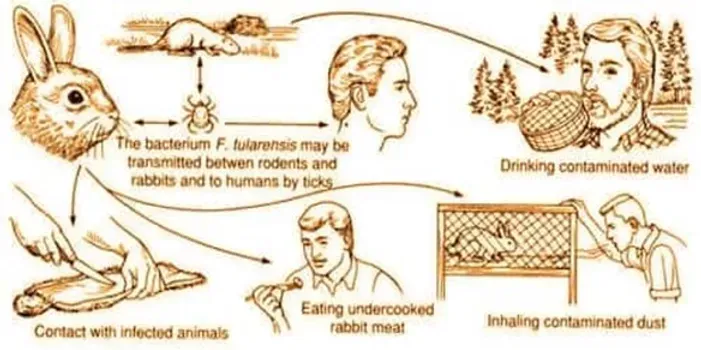Lyme Coinfection Series-Tularemia