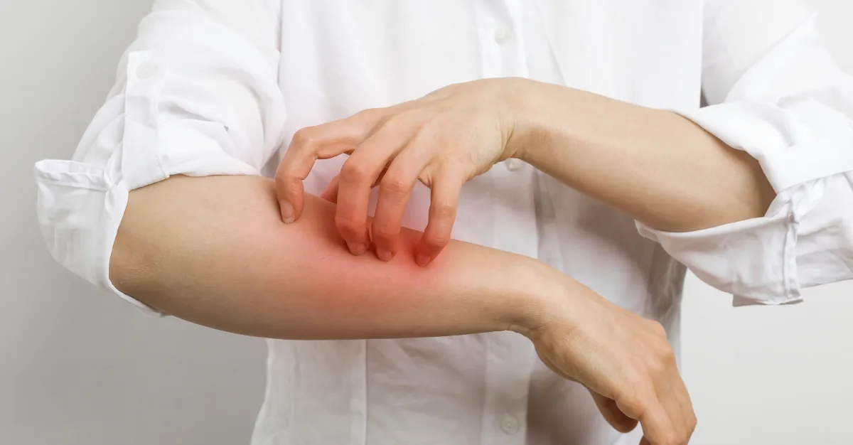Histamine Overload: Why You Feel Awful and What to Do About It