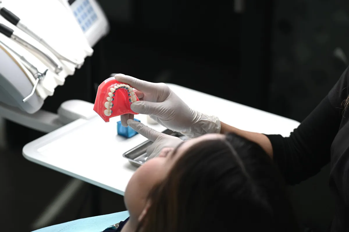 Cuidado Ortodoncia Lingual