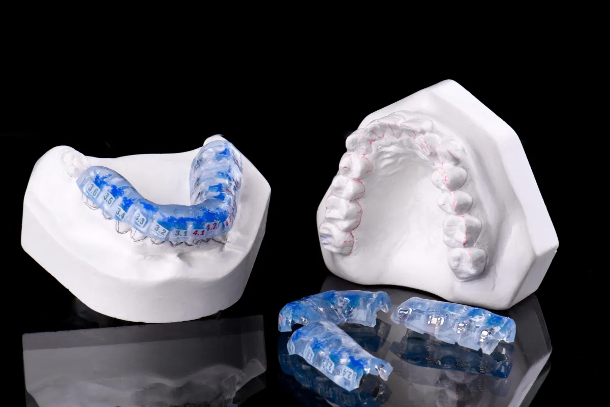 ortodoncia, clinica lingual, brackets invisibles, alineadores, frenillos linguales
