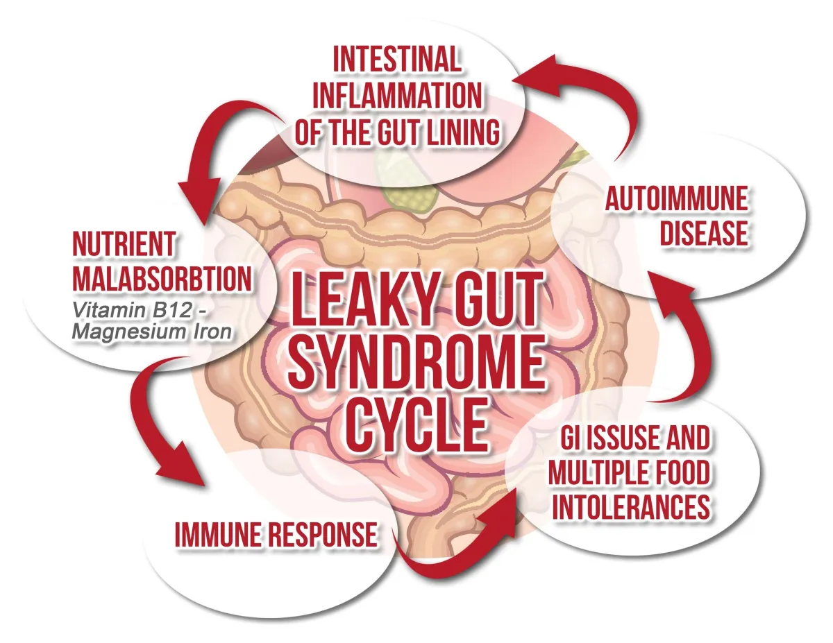 gut system