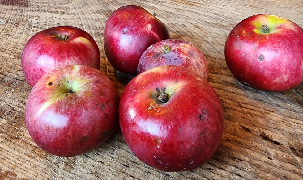 How Gut Health Influences Anxiety and Depression