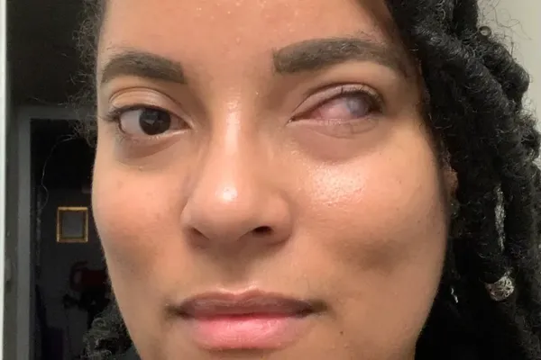 Robin Fernandez, 41