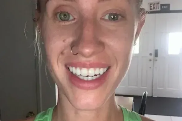 what-happens-after-you-lose-an-eye