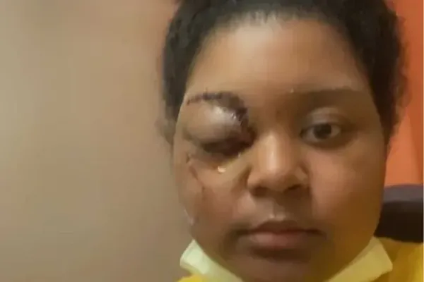 Evette, 17 - Car Accident