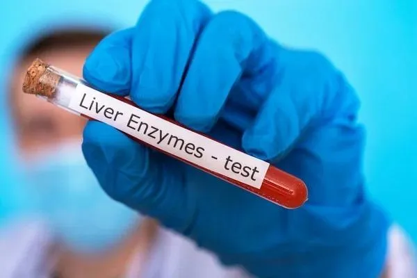 HIGH LIVER ENZYMES