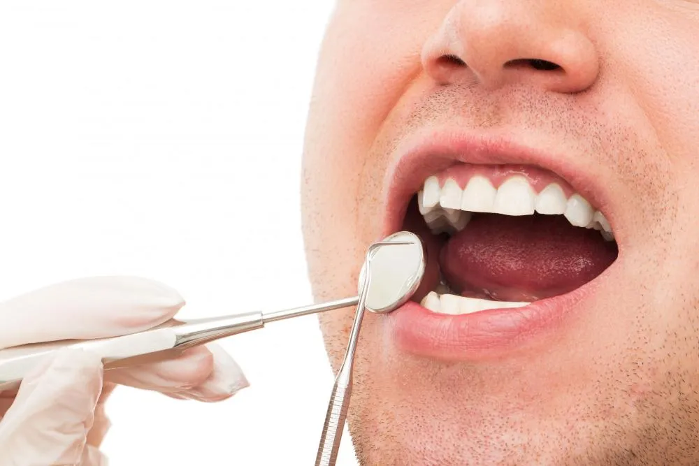 Revisión Dental