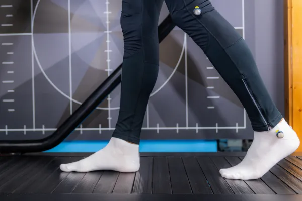 Gait Analysis in Bishopbriggs: How It Can Help You Walk and Run Better