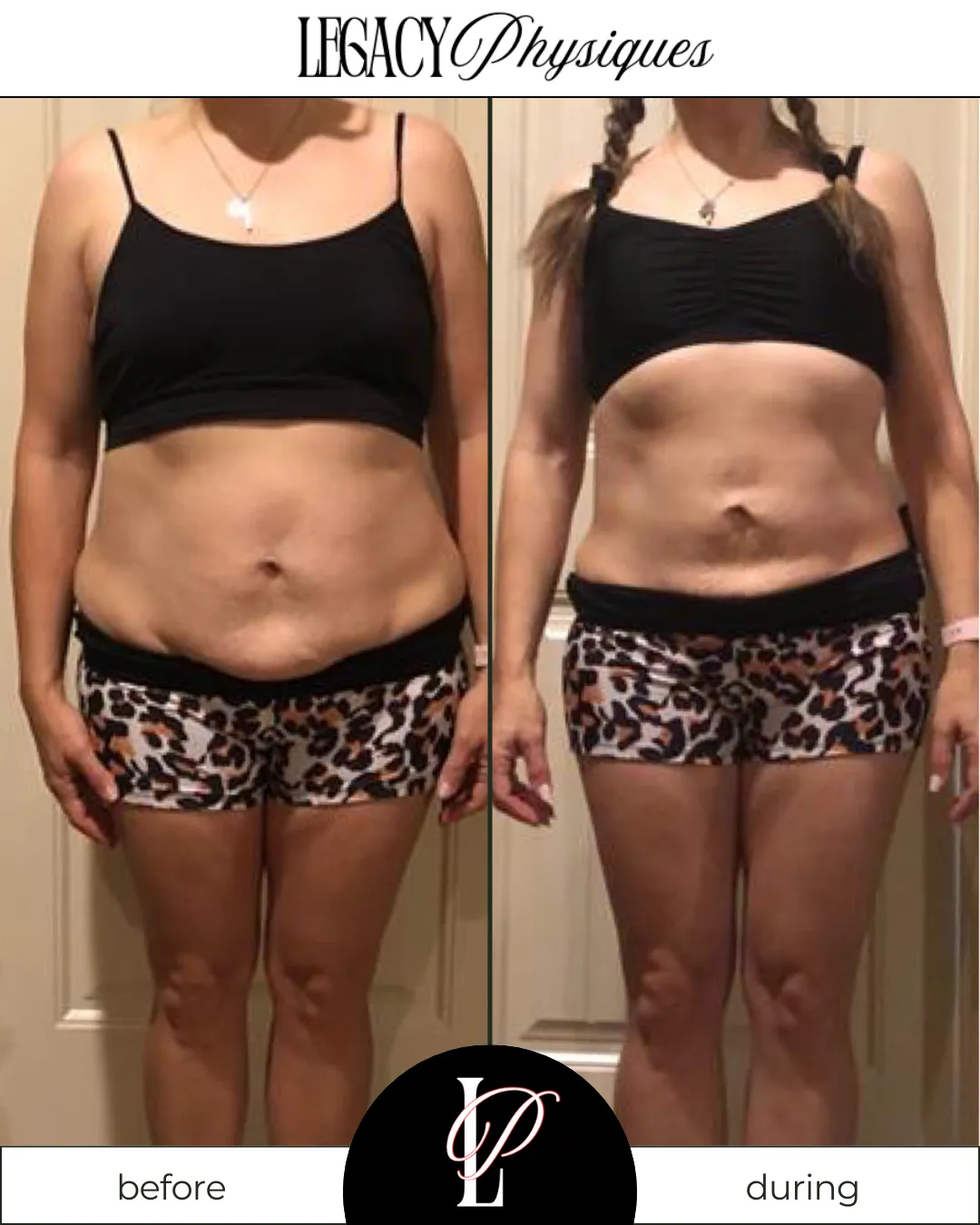 Legacy Physiques client transformation photo showing visible fat loss and muscle definition, highlighting the results of Lindsey Black’s personalized women’s fitness and nutrition coaching.