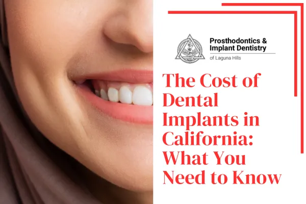 The Cost of Dental Implants in California: What You Need to Know with image of a smile