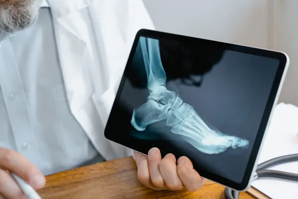 doctor showing foot injury xray