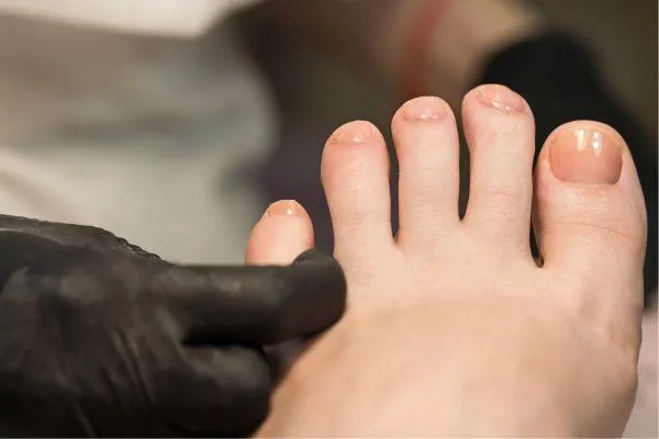 Preventing Future Nail Damage After Reconstruction