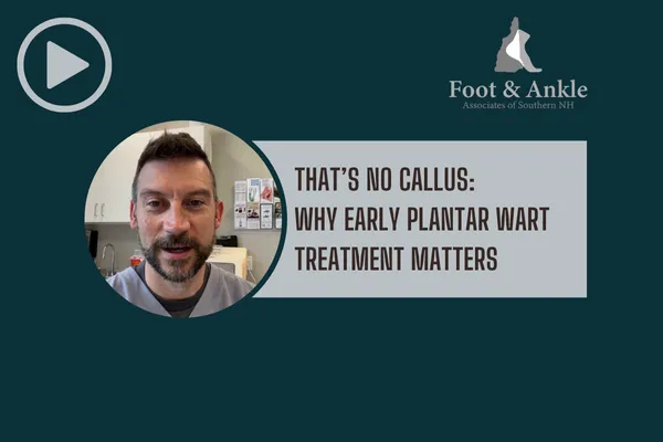 That’s No Callus: Why Early Plantar Wart Treatment Matters