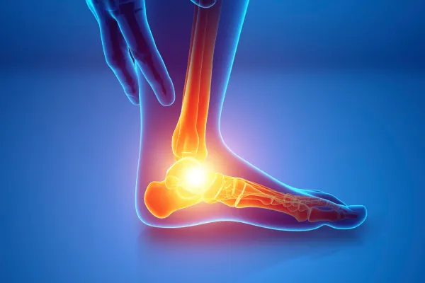 Charcot Foot: A Complication of Diabetes That Needs Fast Action