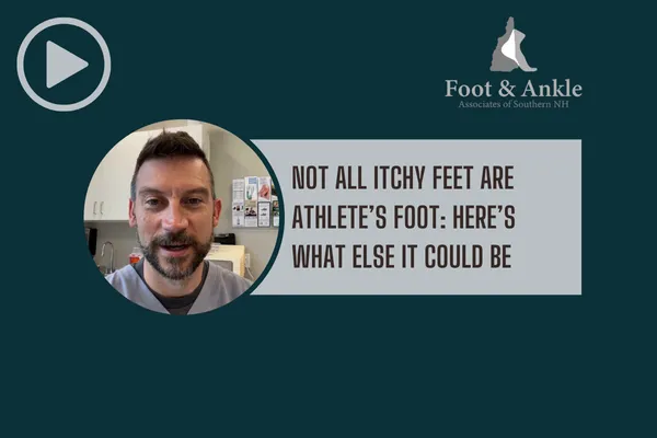 Not All Itchy Feet Are Athlete’s Foot: Here’s What Else It Could Be