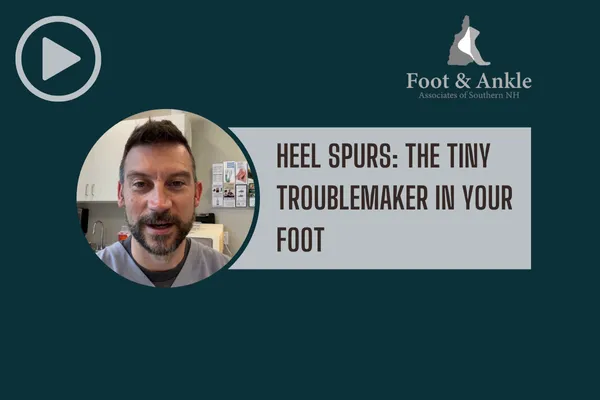 Heel Spurs: The Tiny Troublemaker in Your Foot - Video Clip