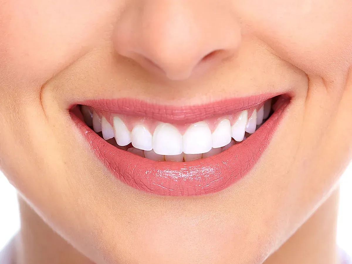 Bonding Restorations