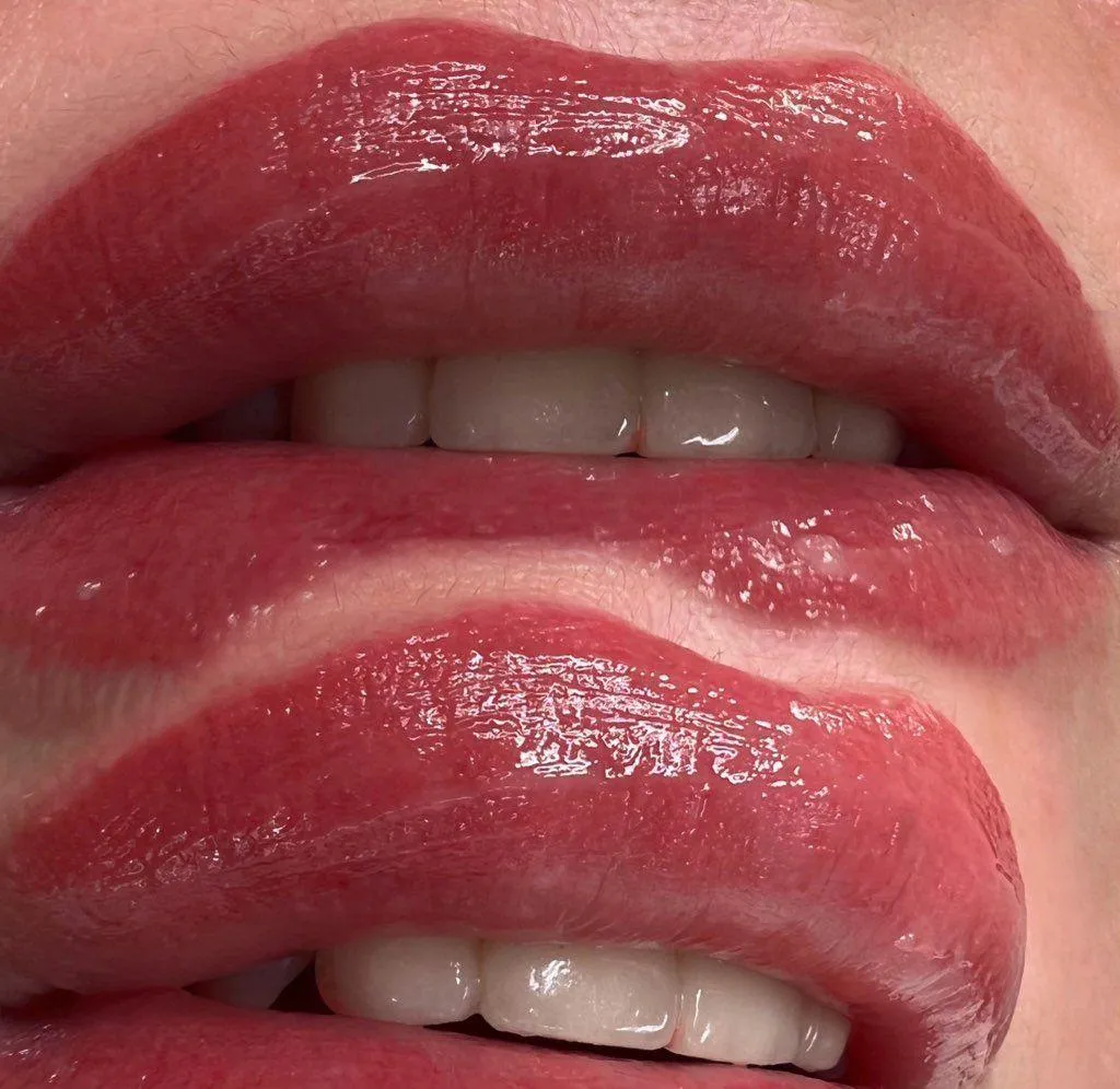 lips post blushing treatment